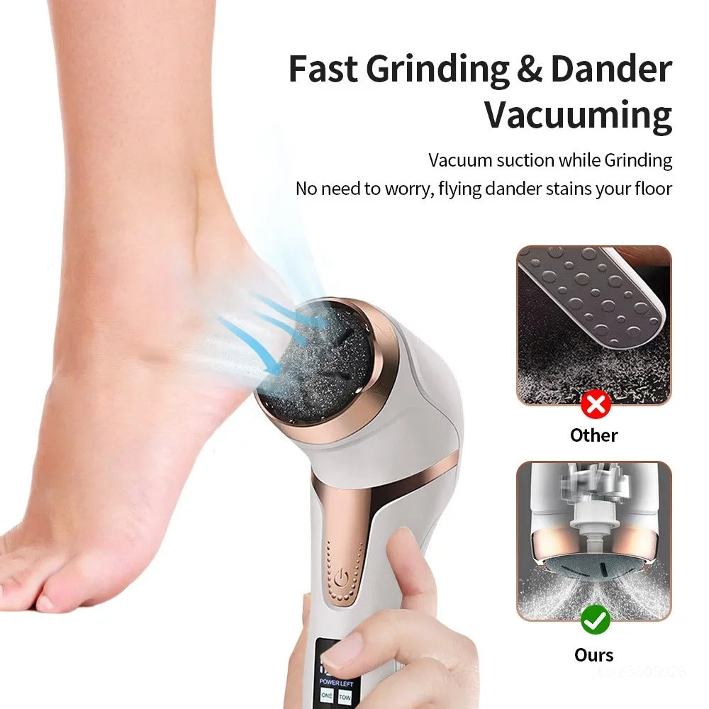 Electric Callus Remover