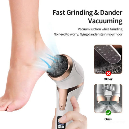 Electric Callus Remover
