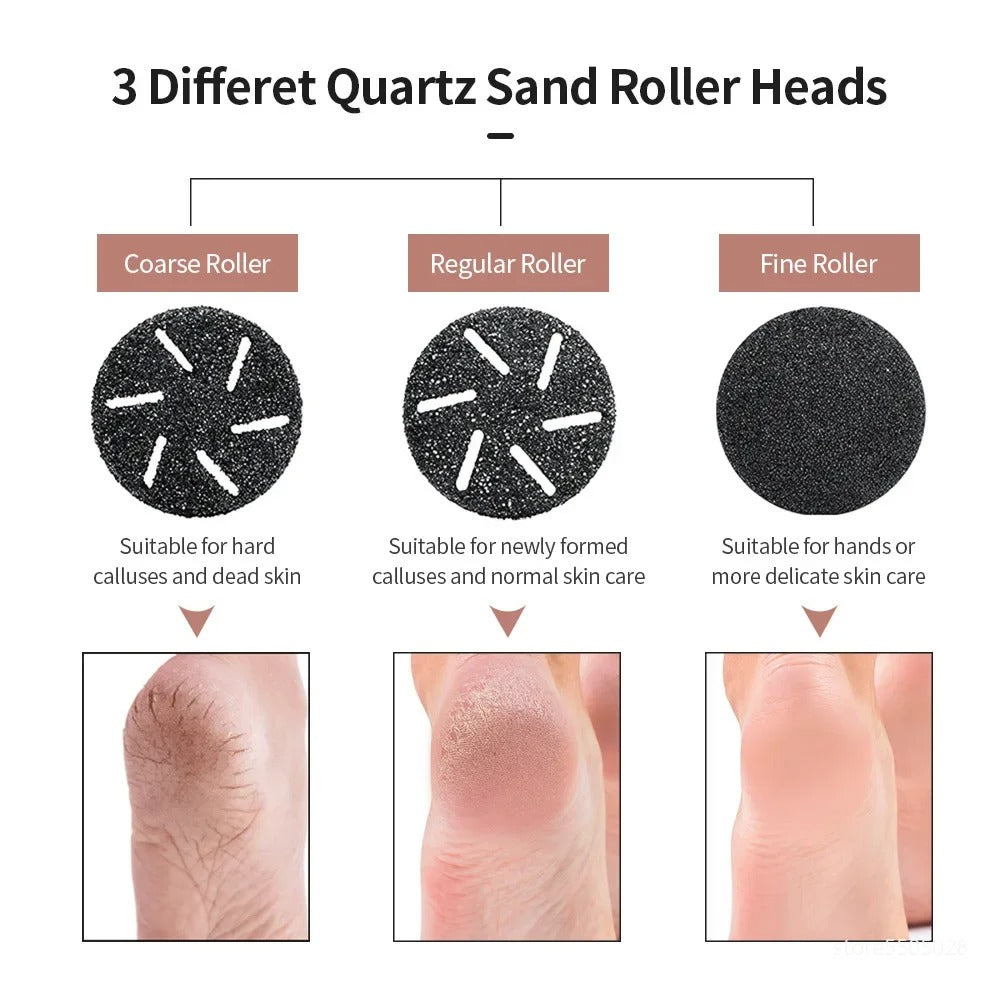 Electric Callus Remover
